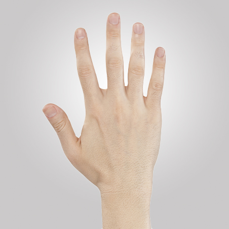 Depilação a laser nas Mãos e Dedos masculino